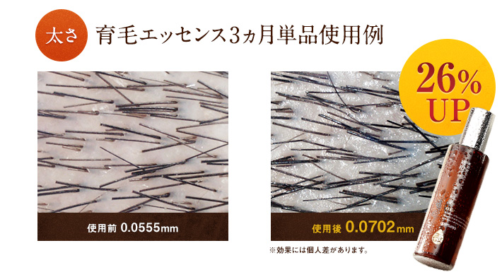 太さ育毛エッセンス3ヵ月単品使用例26%UP 太さ育毛エッセンス3ヵ月単品使用例26%UP